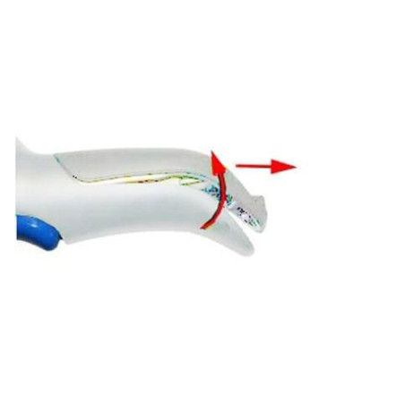 Battery pack, removable, white