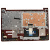 upper case assembly