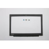 Bezel