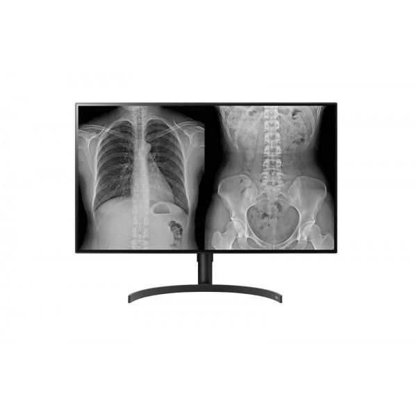 lg-medical-display-32-1.jpg